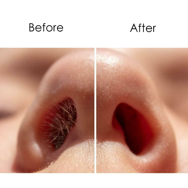 Nose Hair Removal Wax Kit Enough for 10 Times
