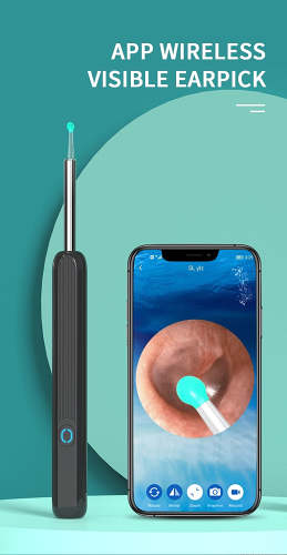 🔥Last Day 50% OFF🔥Clean Earwax - 1080P HD Loaded Otoscope