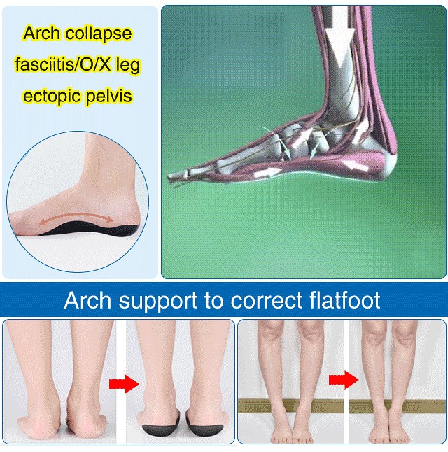 Arch Support Insole