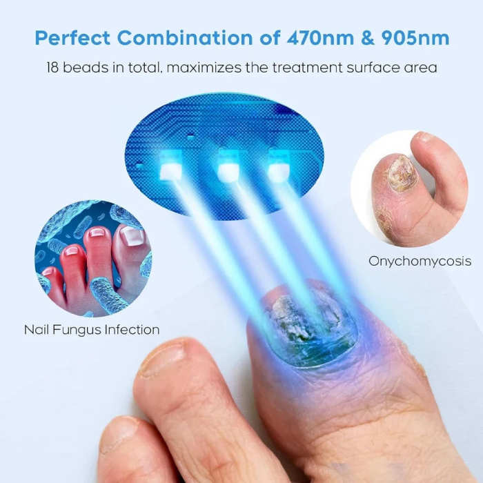 Fungal Nail Laser Device
