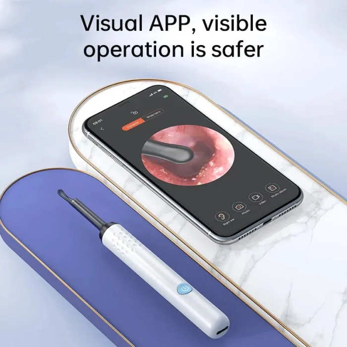 Digital visual ear cleaner (wi-Fi)