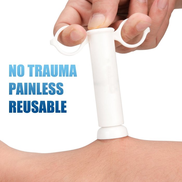 Insect Bite Relief Suction Cups