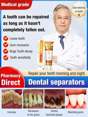 Dental separators by Veasoon