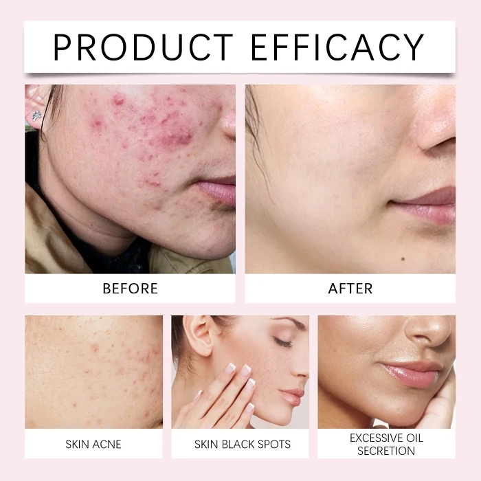 Buy more save more Turmeric Kojic Acid Cleansing Pads