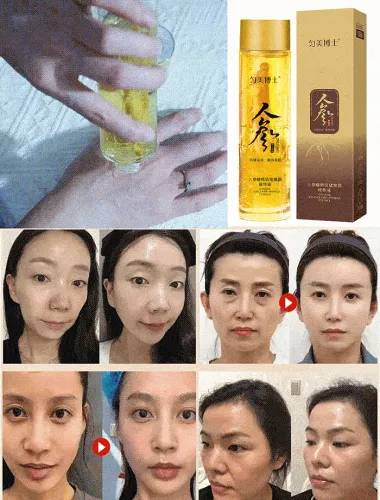 Last Day Promotion - 49% OFF [30 years younger] Ginseng Extract Liquid by Veasoon