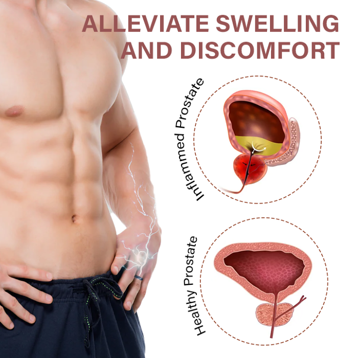 Oveallgo MagnaCopper Prostate Relief Ring