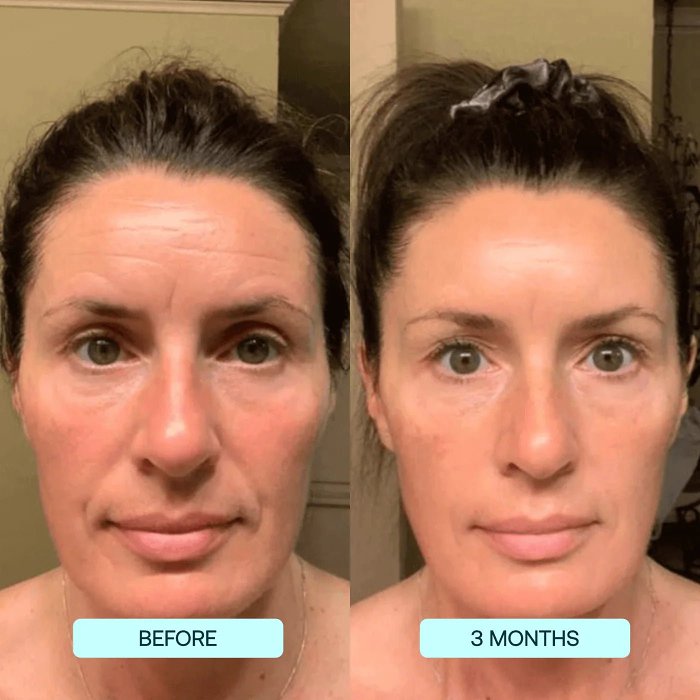 Buy 1 Free 1-Highprime Collagen Film