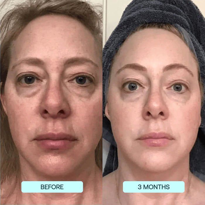 Buy 1 Free 1-Highprime Collagen Film