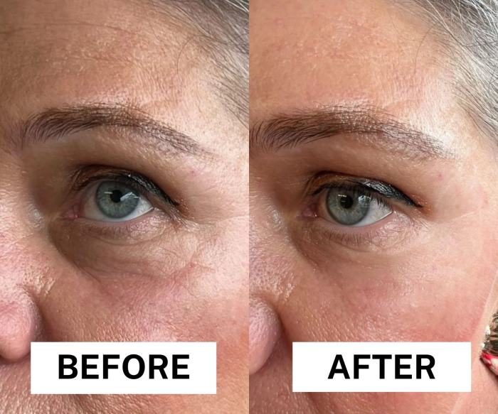 Instant  Eye Temporary Eye Tightener