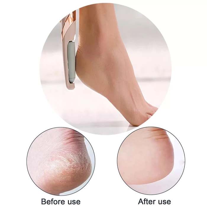 Latest Electric Foot File Hard Skin Remover