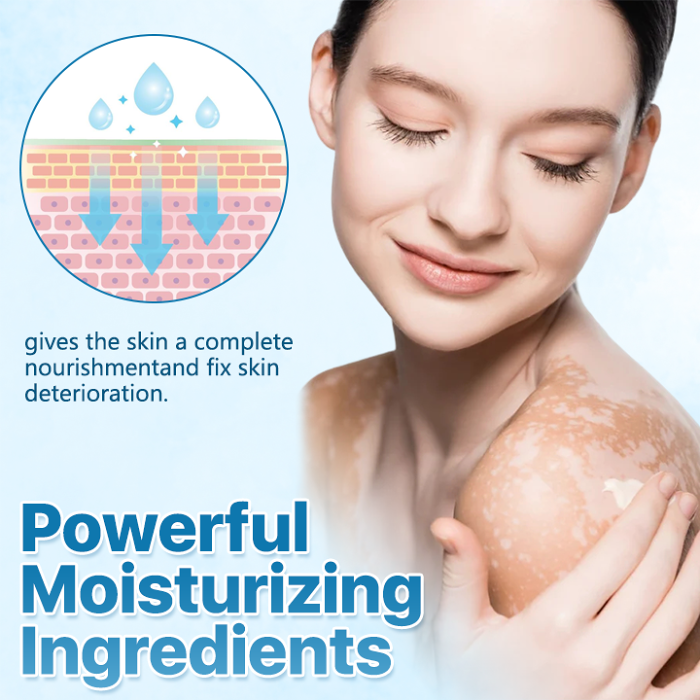 Biancat Vitiligo ReBalance Soothing Ointment