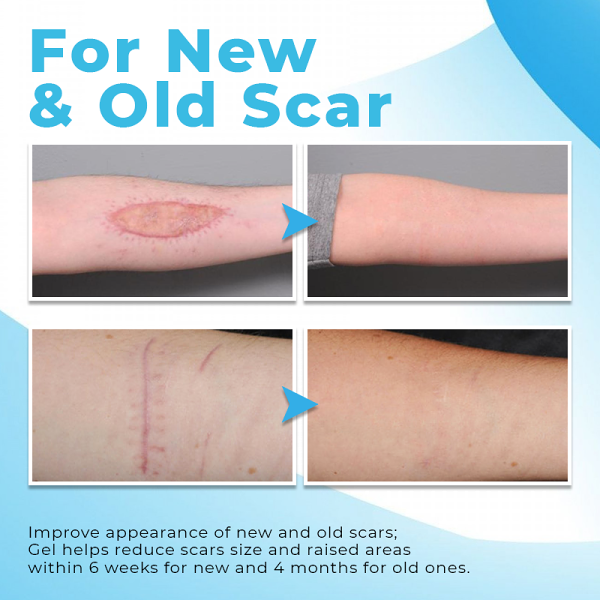 Biancat PureHeal Scar Removing Gel