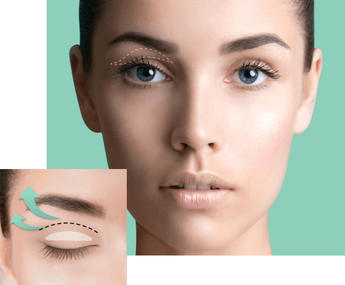 Waterproof Double Eyelid Tapes