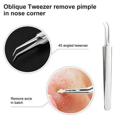 Professional Facial Blackhead Remover Tweezers