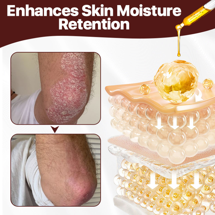 Biancat Cow's Fart Eczema Essence