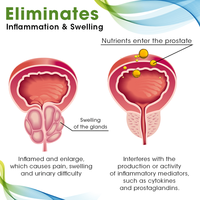 Biancat ProstoCare Prostate Support Drops