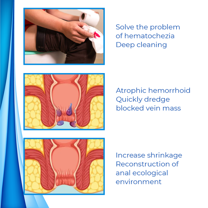 Biancat HemoEase Herbal Hemorrhoid Relief Cream