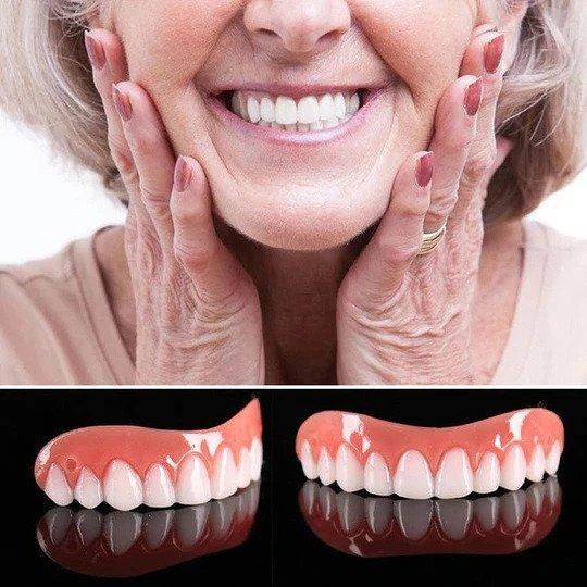 Perfect Smile Veneer (Upper & Lower)