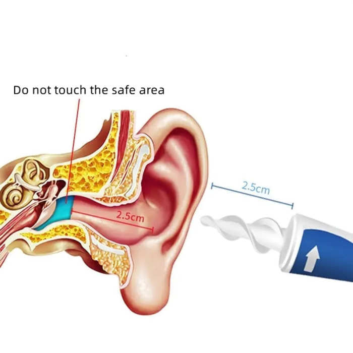 Spiral Ear Wax Cleaner Kit by Veasoon