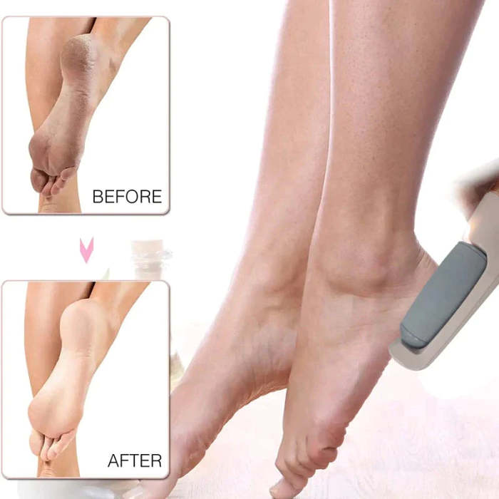 Rechargeable Electric Foot File Callus Remover