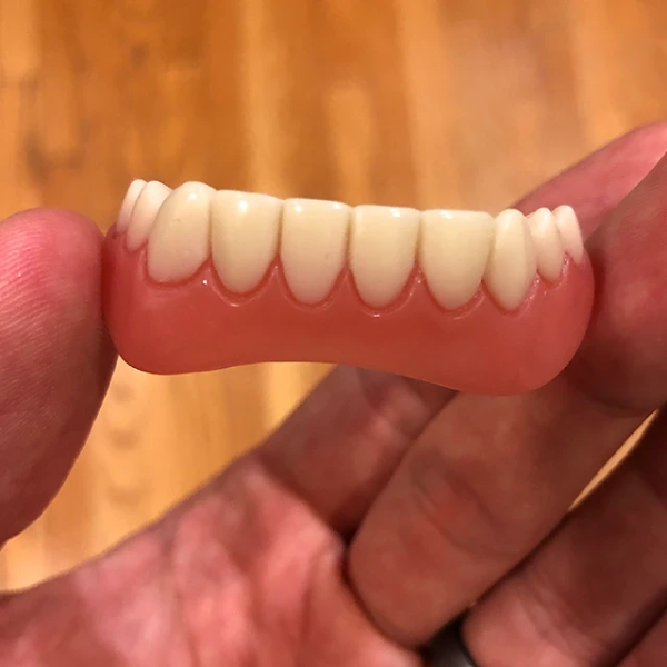 Perfect Smile Veneer (Upper & Lower)