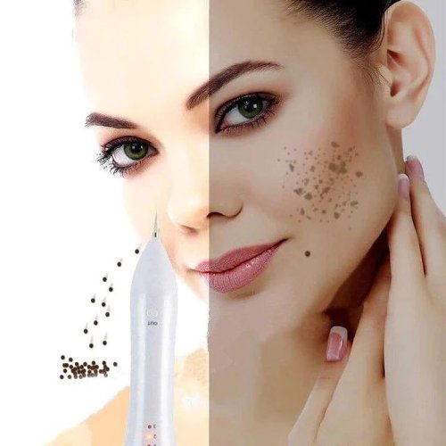 Portable Beauty Mole Removal Pen - Multi-Level Skin Tag Repair Kit
