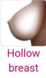 hollow breast