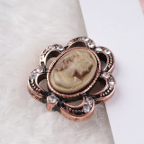 20MM yellow snap rose-gold plated with rhinestones KC6216 snaps jewelry