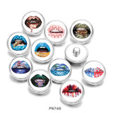 20MM   Lips  Print   glass  snaps buttons