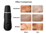 Rechargeable Ultrasonic Blackhead Removal Exfoliating Pore Cleaner Tools
