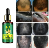 Hair Growth Essence Natural Beauty Hair Growth Fluid Hair Growth Essence Oil
