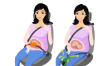  Pregnant Car Seat Belt