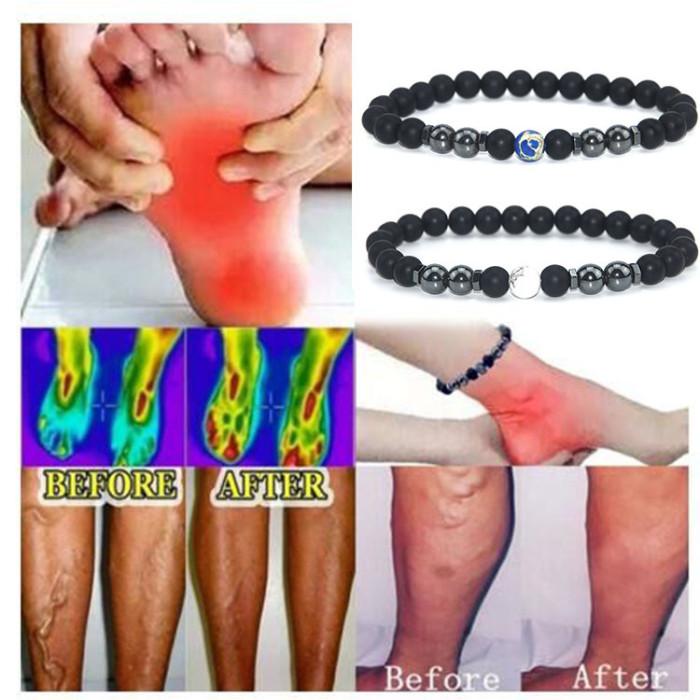 Cross-Border New Matte Black Bead Magnetic Anklet European and American Retro Snowflake Stone Magnetic Foot Jewelry Large Quantity at Great Price