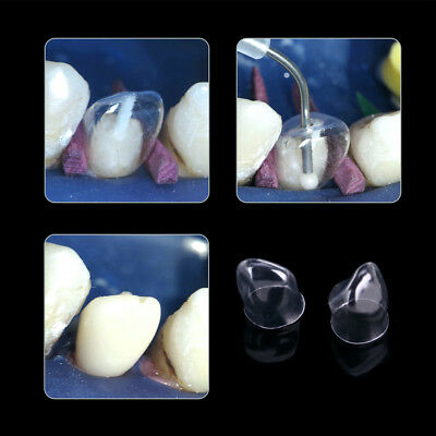 Dental Transparent Crown Anterior Matrices Matrix for Adult TOR BM