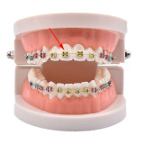 2080Pcs Orthodontic Ligature Ties Soft Multi-Color Orthodontic Elastomeric Rings Braces Rubber Bands for Braces Brackets(2 bag,1040pcs/bag)