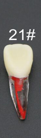 Dental Tooth Root Canal Model Dental For RCT Practice Medullary Pulp Cavity Clear Resin