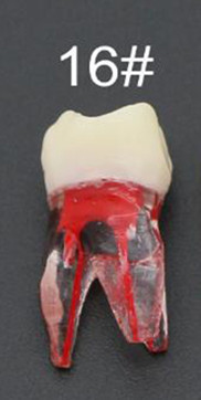 Dental Tooth Root Canal Model Dental For RCT Practice Medullary Pulp Cavity Clear Resin