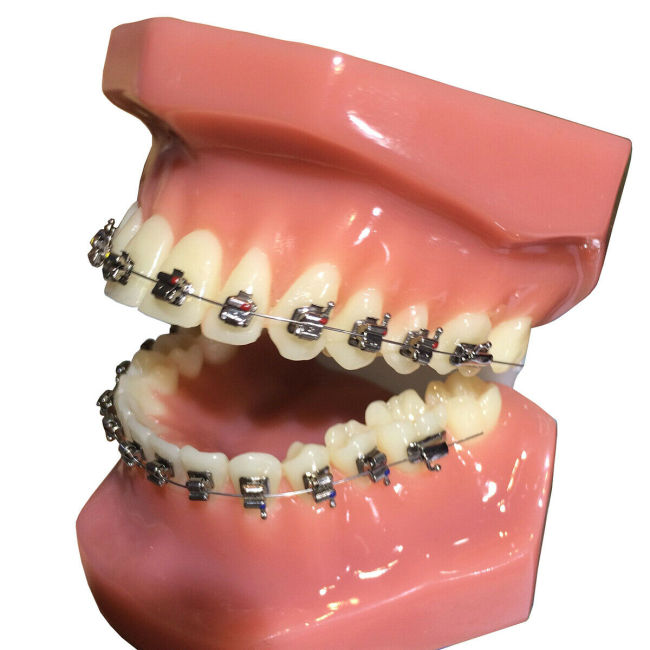 28Pcs Dental Orthodontic Brace Brackets Self-Ligating Active Mini Roth 022 Hooks 3-4-5