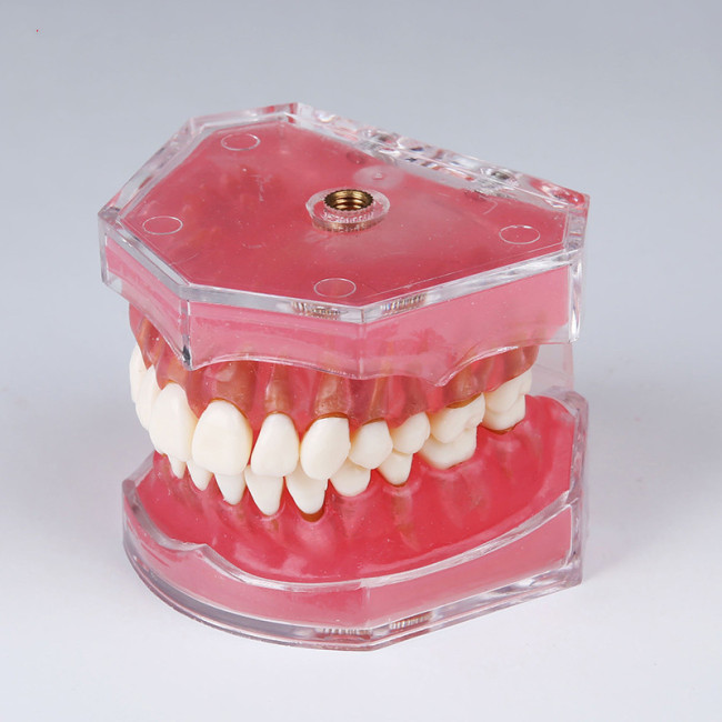Dental Demonstration Standard Typodont Teeth Model Dental Study Teach Model Demonstration Clear Model with Teaching and Science
