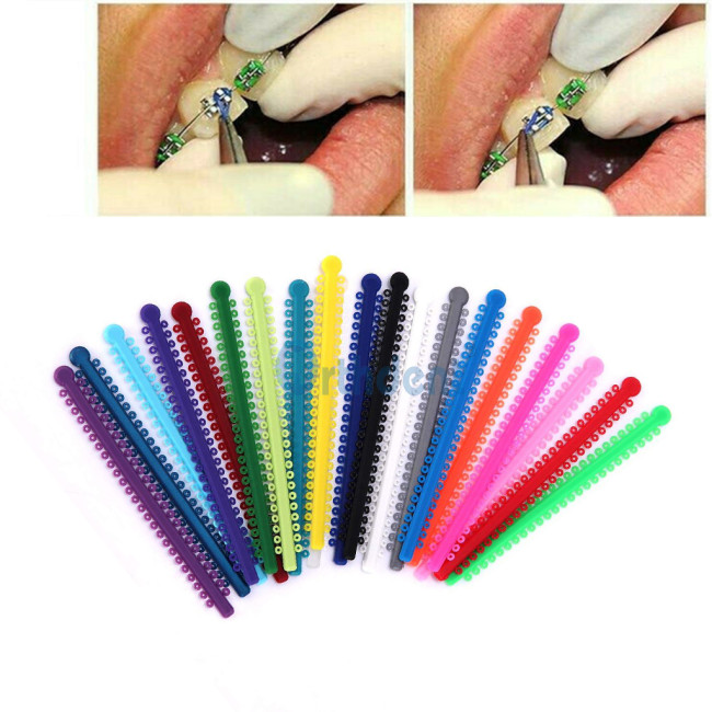 1000 Pcs/Pack Dental Ligature Ties Orthodontic Elastic Rubber Tooth Dentist Tools Braces Teeth