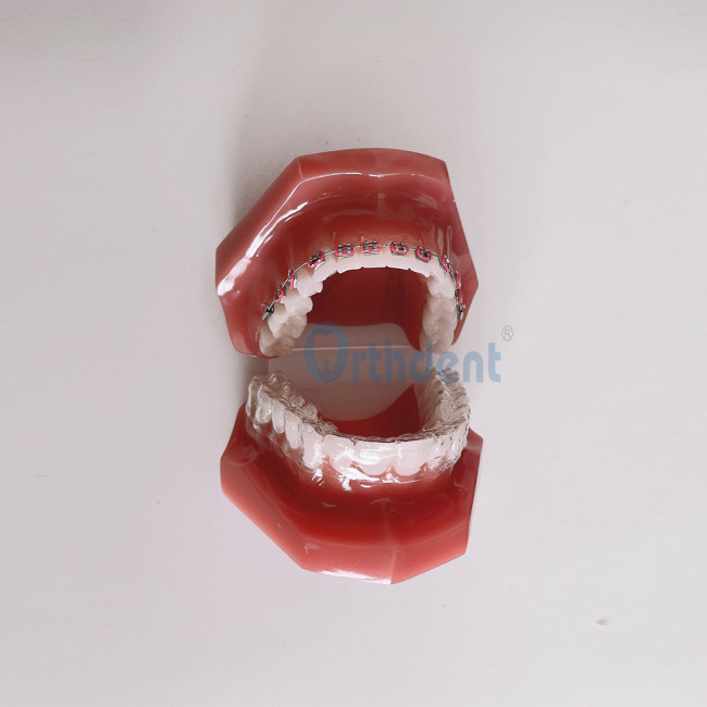 Dental Model Invisible Orthodontics Retainer Tooth Model with Metal Bracket Arch Wires Ligature Ties Teaching Studying Dentistry Tool