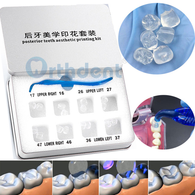 Orthdent Dental Posterior Teeth Aesthetic Printing Mould Kits Perfectly Reshape Restoration Teeth Filling Oral Therapy Tools