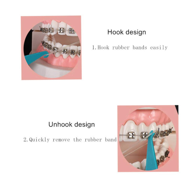 100Pcs/Bag Disposable Dental Elastic Placer for Braces Bands Rubber Ligature Ties Ring Retractor Dentist Orthodontic Consumables
