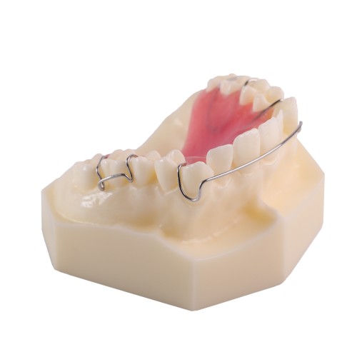 1 Pcs Dental Retainer Study Model M3007 Demonstrates Hawley Retainer for Using and Dentist Lab Researching Practice Equipment