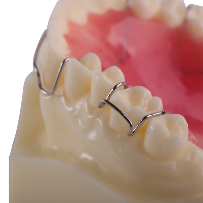 1 Pcs Dental Retainer Study Model M3007 Demonstrates Hawley Retainer for Using and Dentist Lab Researching Practice Equipment