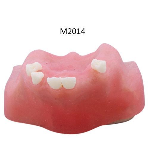 1Pcs Dental Implant Practice Model Maxillary Sinus Elevation Sine Lifting Tooth Models Bone Imitating Dentist Lab Teaching Tools