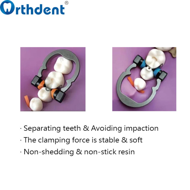 Dental Niti Spring Clamping Ring R5 1.0 Autoclavable Matrix Clip NITI Clamps Separating Green/Orange/Blue Orthodontic Materials