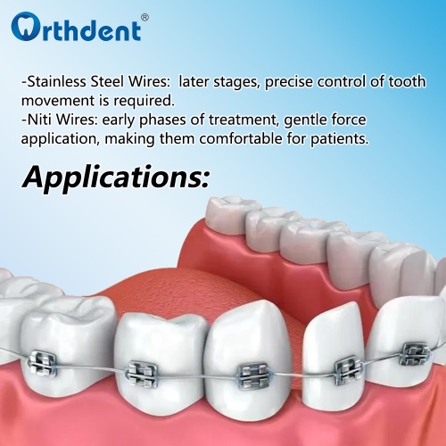 1 Pack Dental Orthodontic Arch wire Super Elastic Niti / Stainless Steel Rectangular/Round Arch Wires Natural/Ovoid Form Dentistry