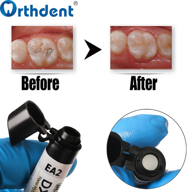 Dentex esthetic resin before and after clinical comparison