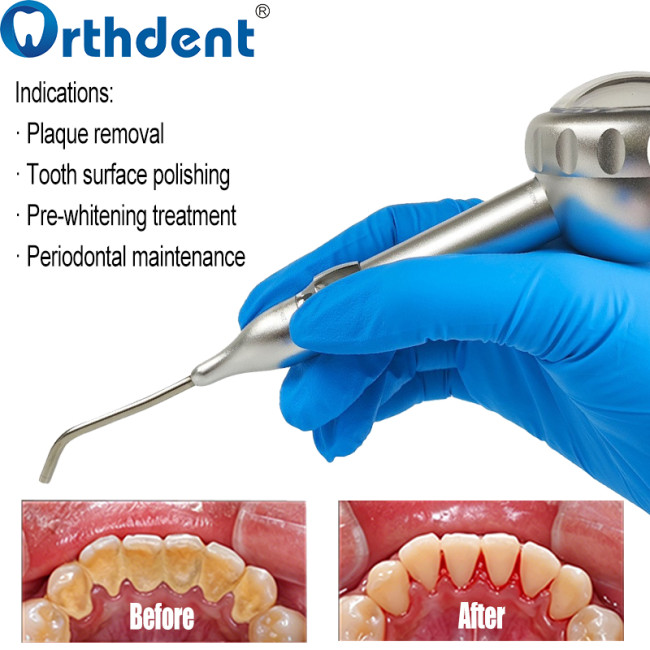 air polisher clinical tooth polishing and stain removal
